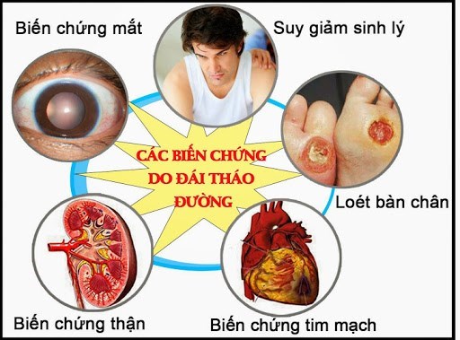 Những biến chứng nguy hiểm của đái tháo đường type 2