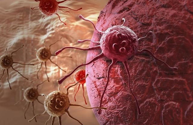 Ung thư là gì? Sự khác nhau giữa tế bào ung thư và tế bào bình thường