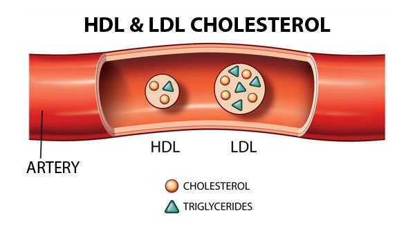 HDL LDL Cholesterol là gì? Tìm hiểu về Cholesterol Tốt và Xấu