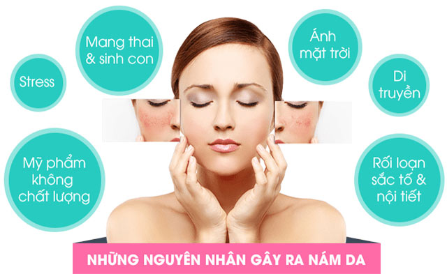 nguyên nhân gây nám da sau sinh